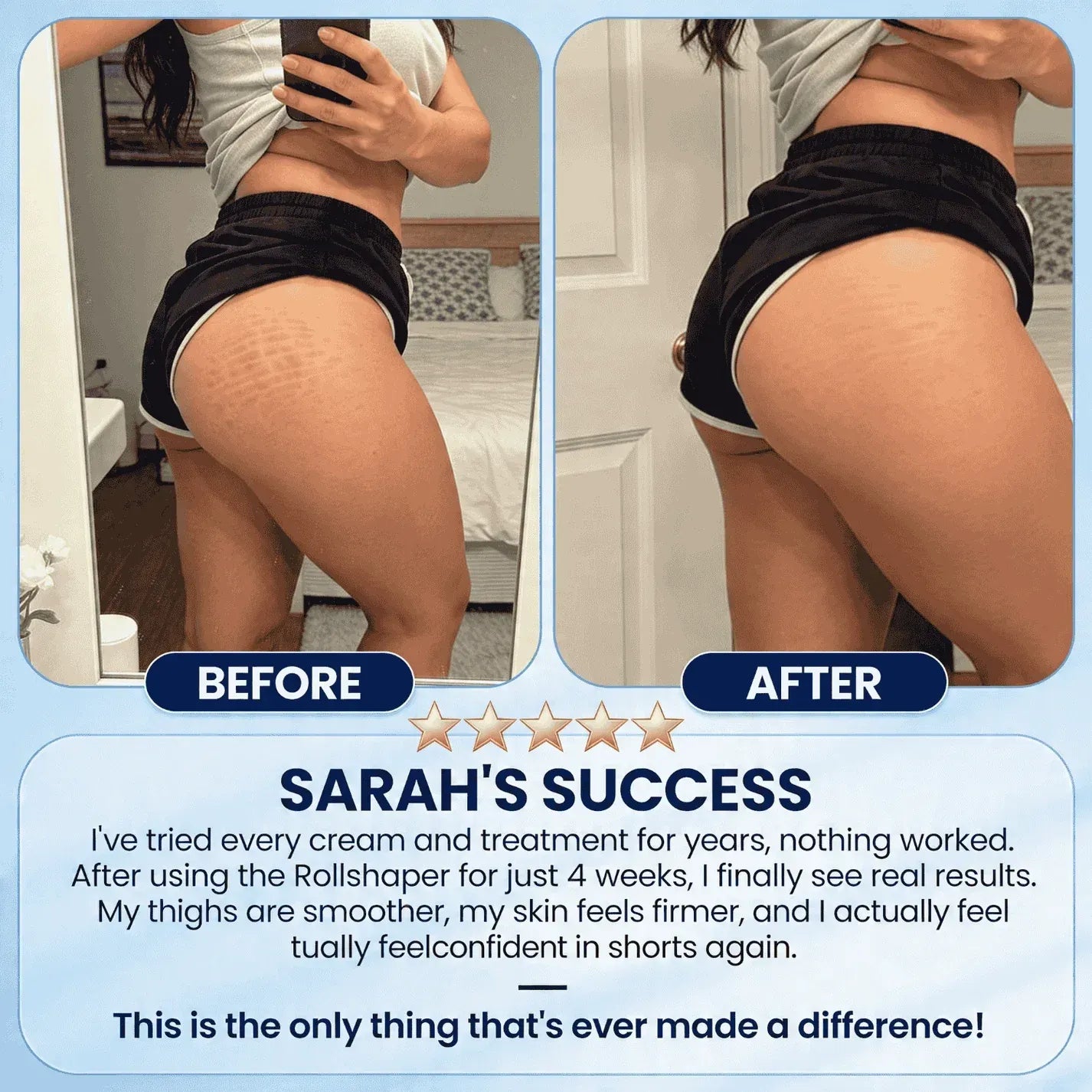 LipoRoll™ – Le Sculpteur Corporel Original Anti-cellulite