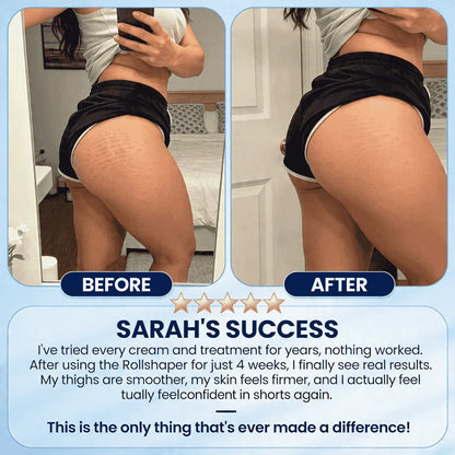 LipoRoll™ – Le Sculpteur Corporel Original Anti-cellulite